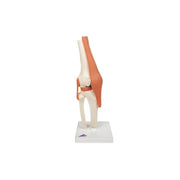 Modèle fonctionnel de luxe de l'articulation du genou - Anatomie et pathologie