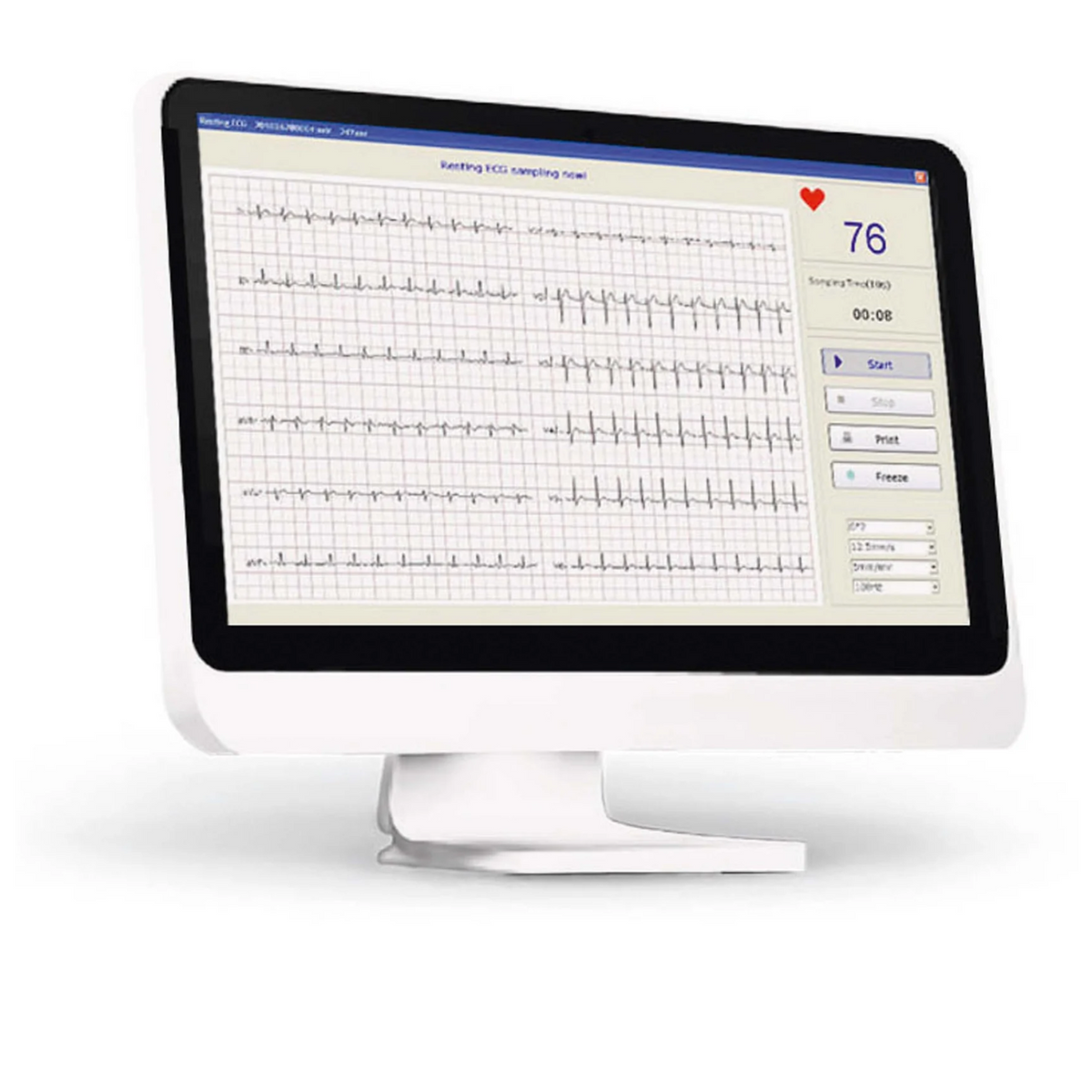 ECG Numerique PC SE-1010 - EDAN - My Médical