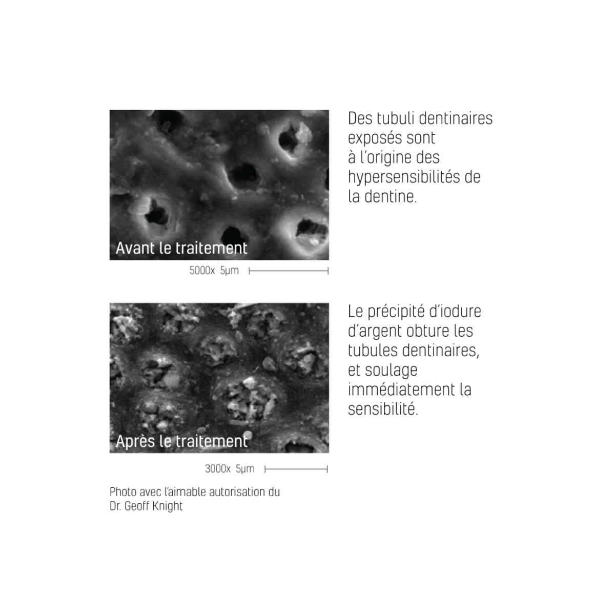 Désensibilisant dentaire Riva Star - flacons/kit capsules - SDI - My Médical
