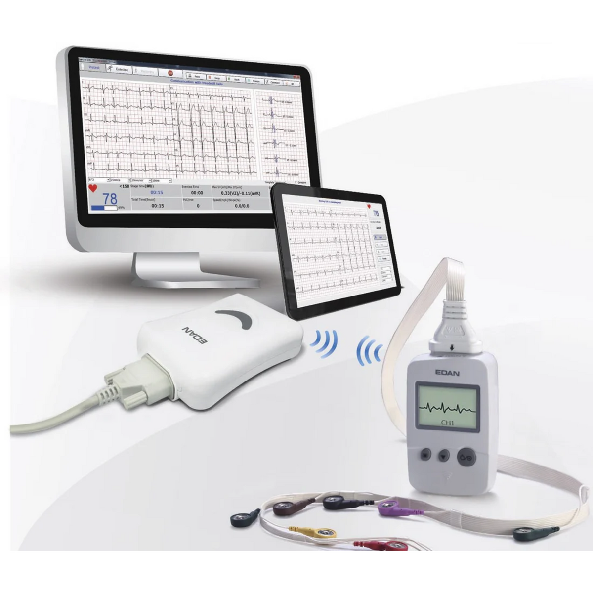 Électrocardiographe Numerique Bluetooth PC SE-1010 - EDAN - My Médical