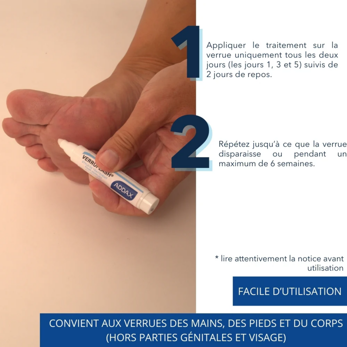 VERRUFLASH® Stylo - Traitement Verrues mains, pieds et corps - 3 ml - Laboratoire Addax Laboratoire Addax 